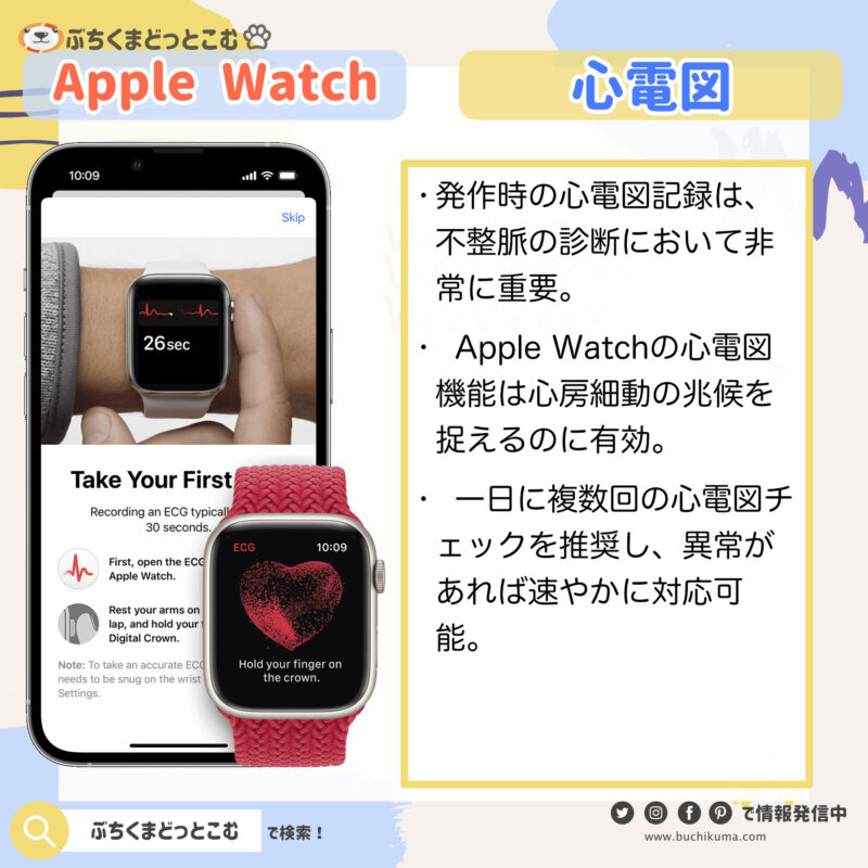「Apple Watchによる不整脈の早期発見と治療」